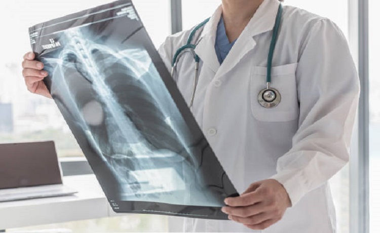 Especialistas Tuberculosis