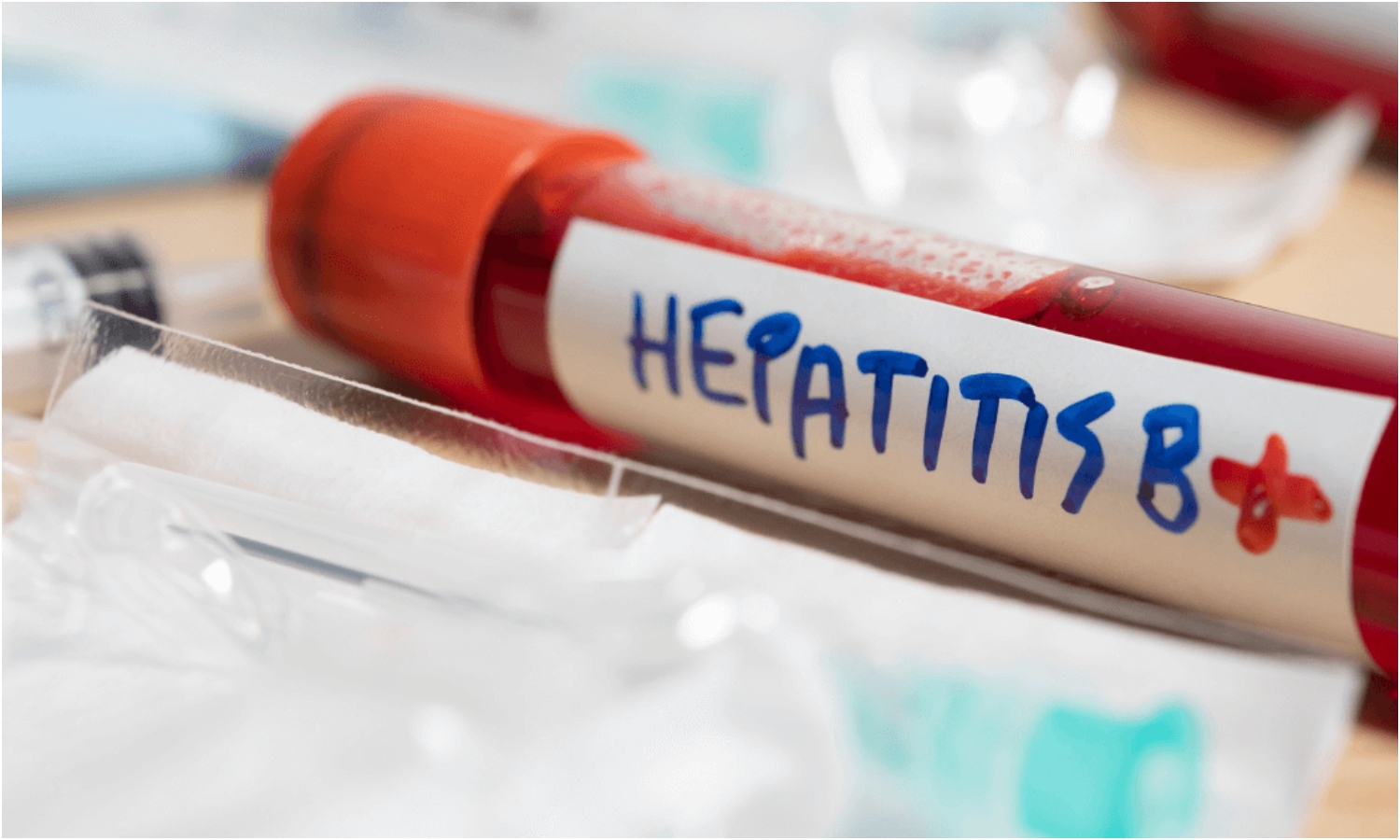 hepatitis