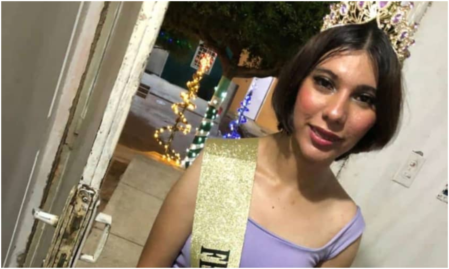 Fallece la zuliana María Elaine tras luchar contra las severas quemaduras que le ocasionó un reto en TikTok