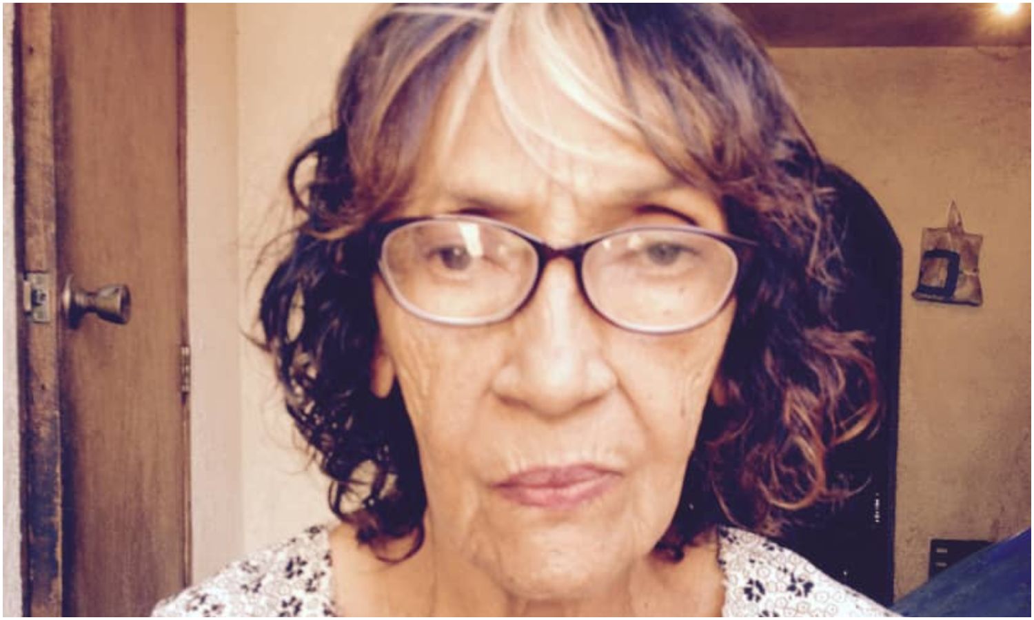 Adulta mayor solicita ayuda urgente para costear cirugía maxilofacial en Maracaibo