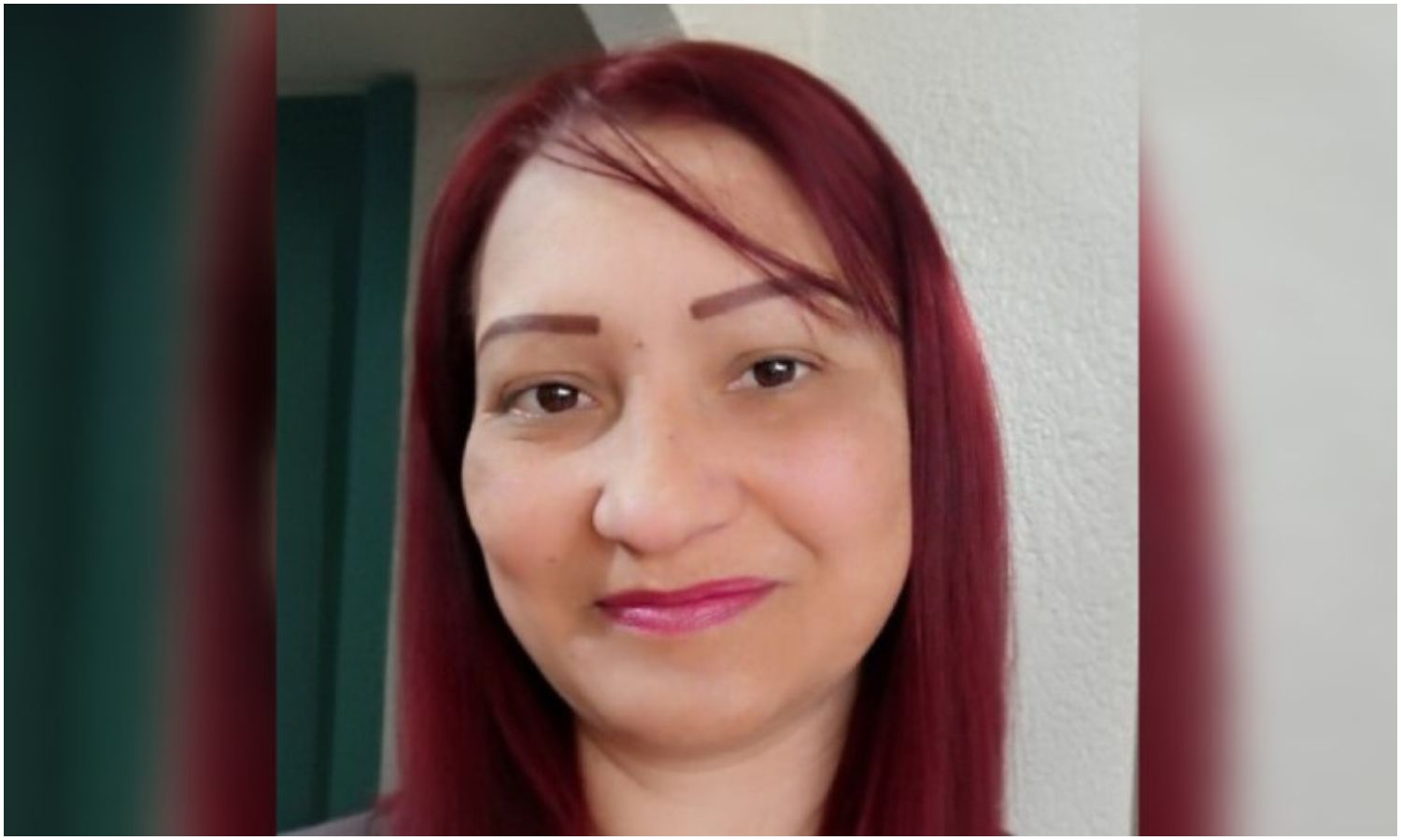 Marabina de 43 años solicita apoyo para someterse a una cirugía cardíaca urgente