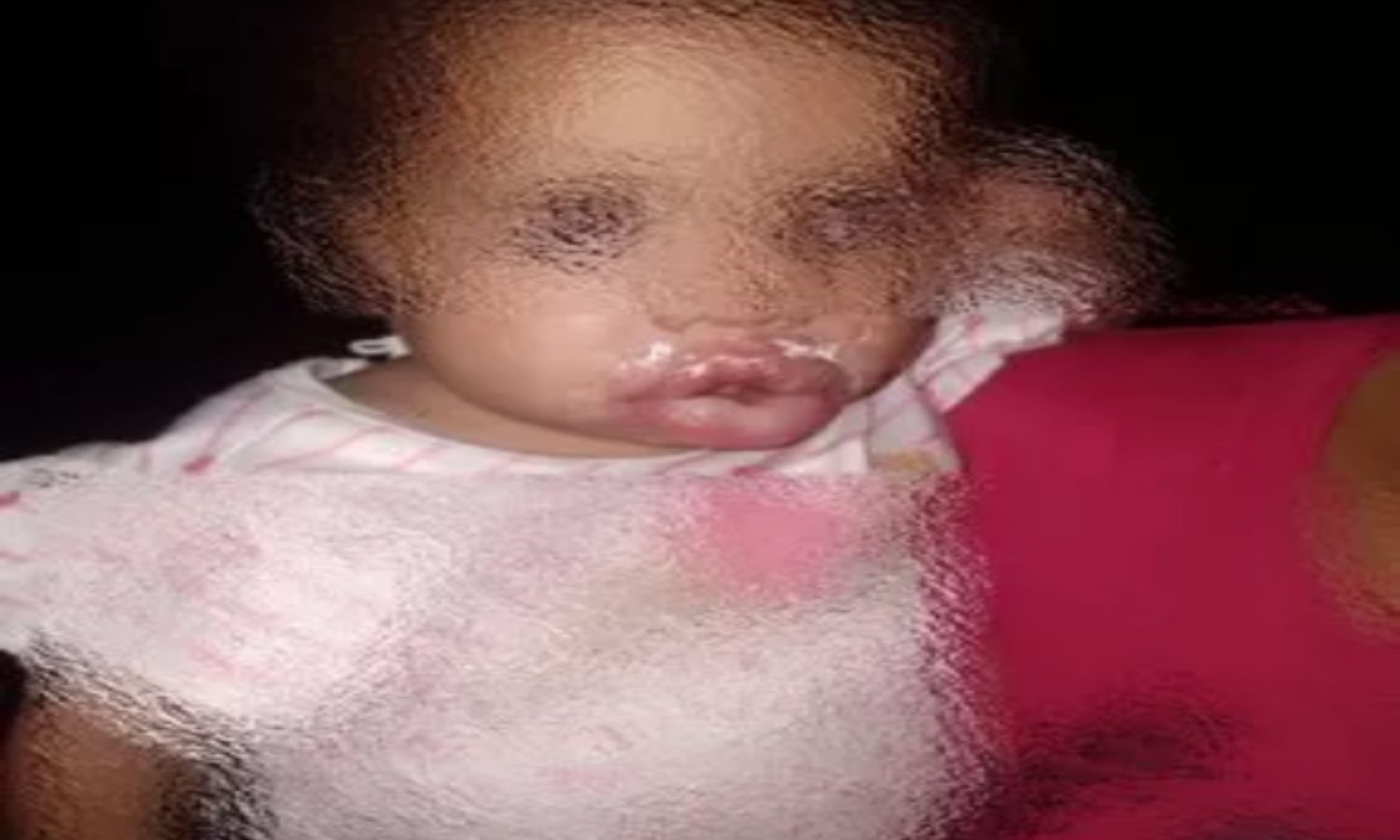 Un sujeto le quemó la boca a su hija de un año de edad en Portuguesa
