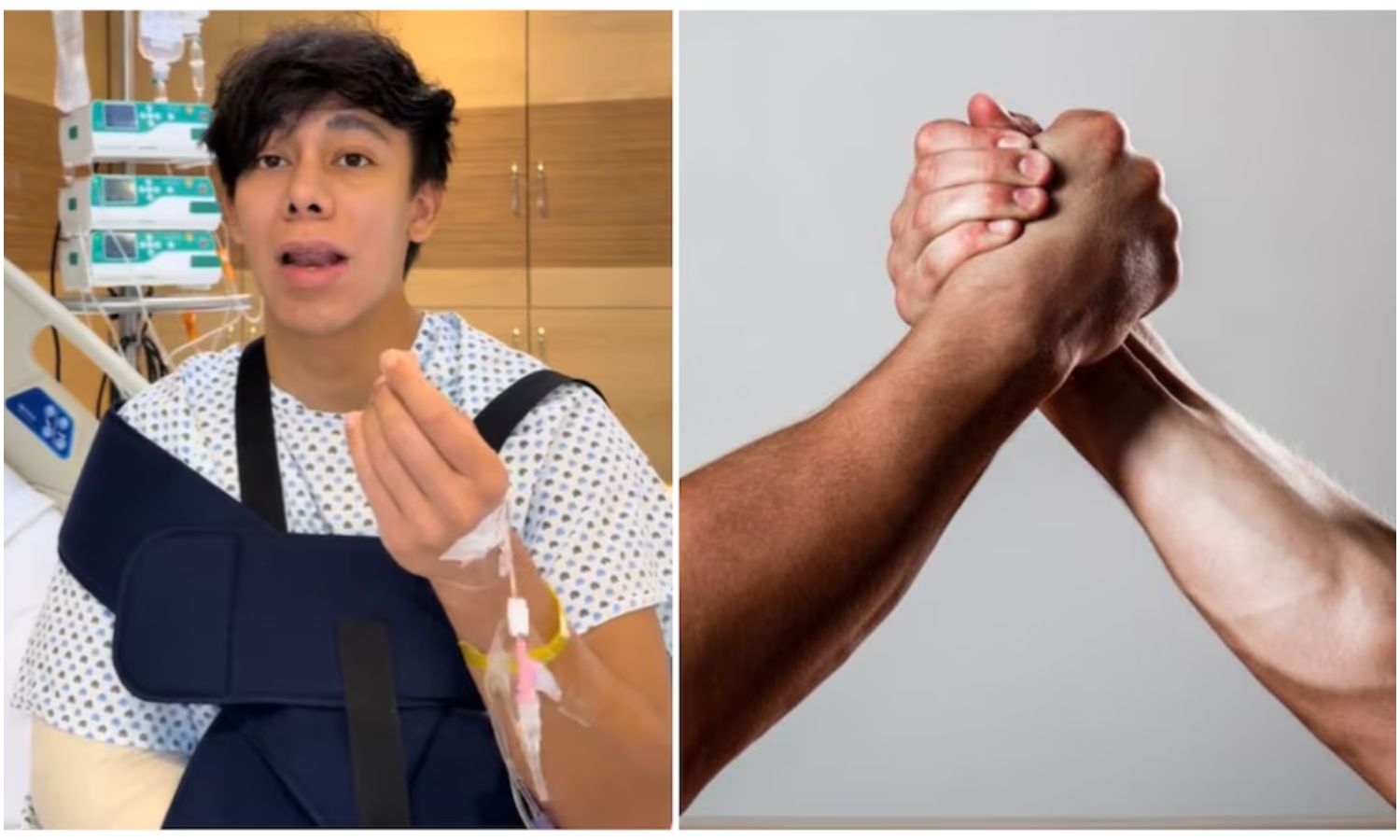 Influencer mexicano podría perder la movilidad de su mano tras romperse el hueso jugando “vencidas”