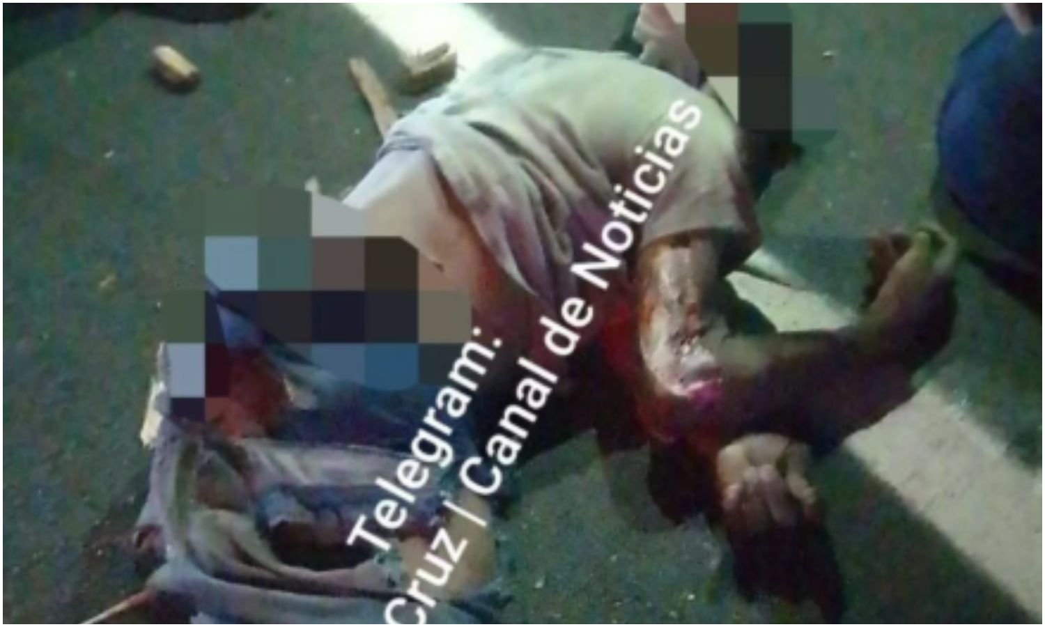 Joven muere arrollado en la Circunvalación 1
