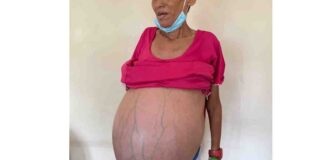 hospital universitario de maracaibo residentes detenidos hum