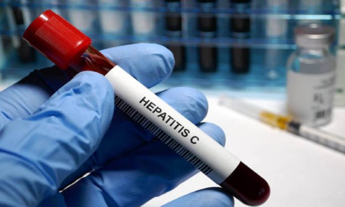 hepatitis c